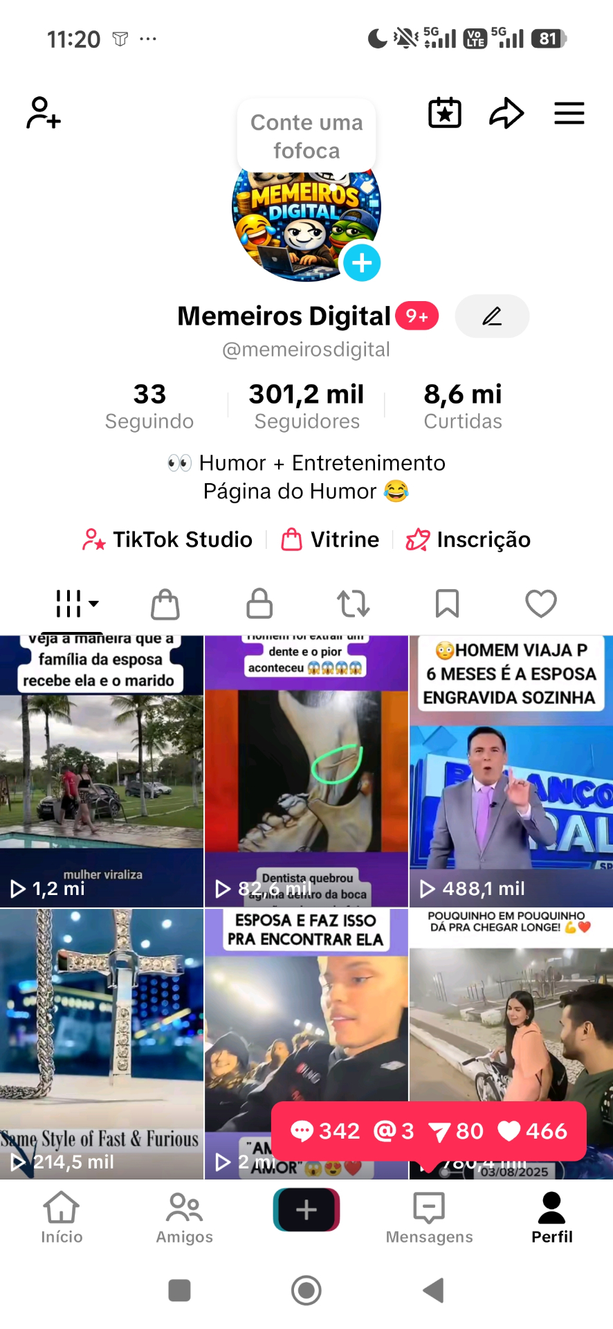 TikTok 300 Mil seguidores [LEIA A LEGENDA]